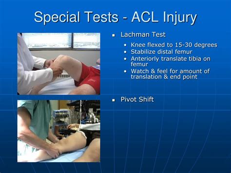 special tests for acl tear|grade 1 sprain of acl.